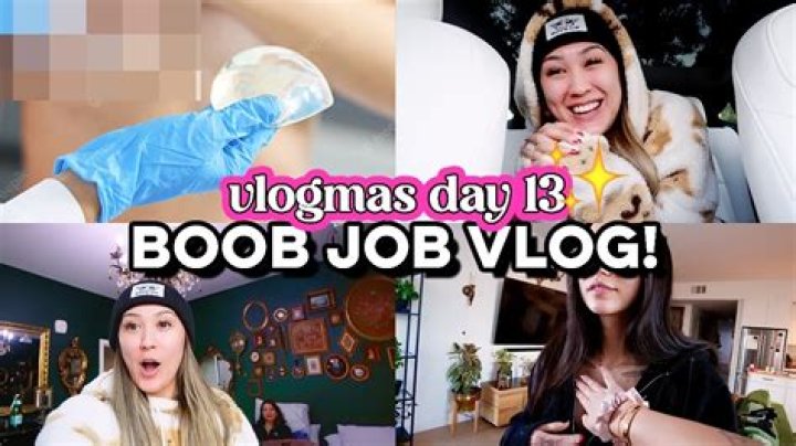 Did Lily Collins Go Under The Knife for a Boob Job? Fact Revealed