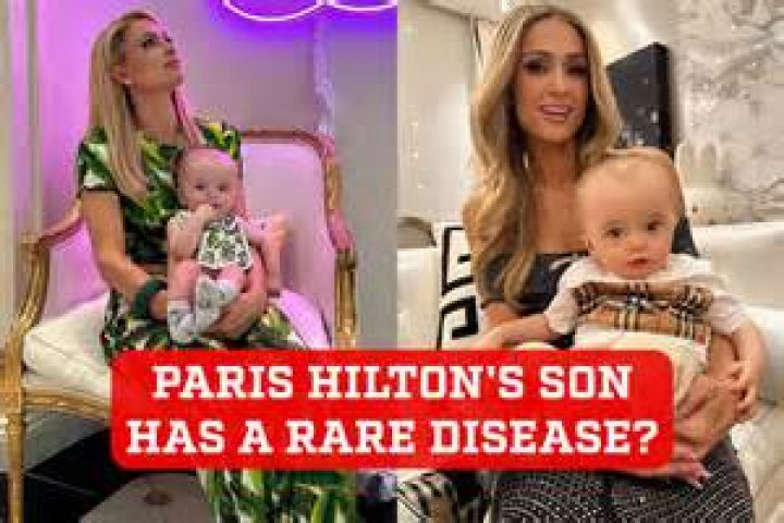 Does Paris Hilton Need Surgery to Fix Her Feet?