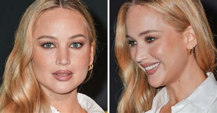 Kitty Jay's $25K Plastic Surgery to Resemble Jennifer Lawrence